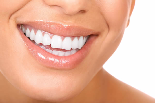 estetica_dentale